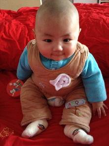 光头宝宝照片图片